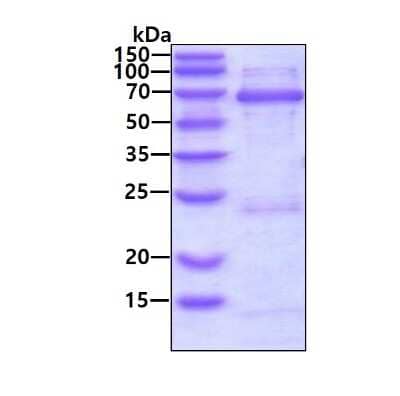 SDS-PAGE Recombinant Human ZWILCH His Protein